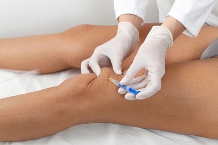 Knee Injections